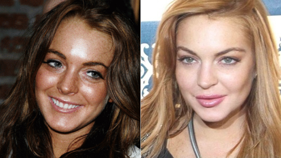 Lindsay Lohan: antes e depois