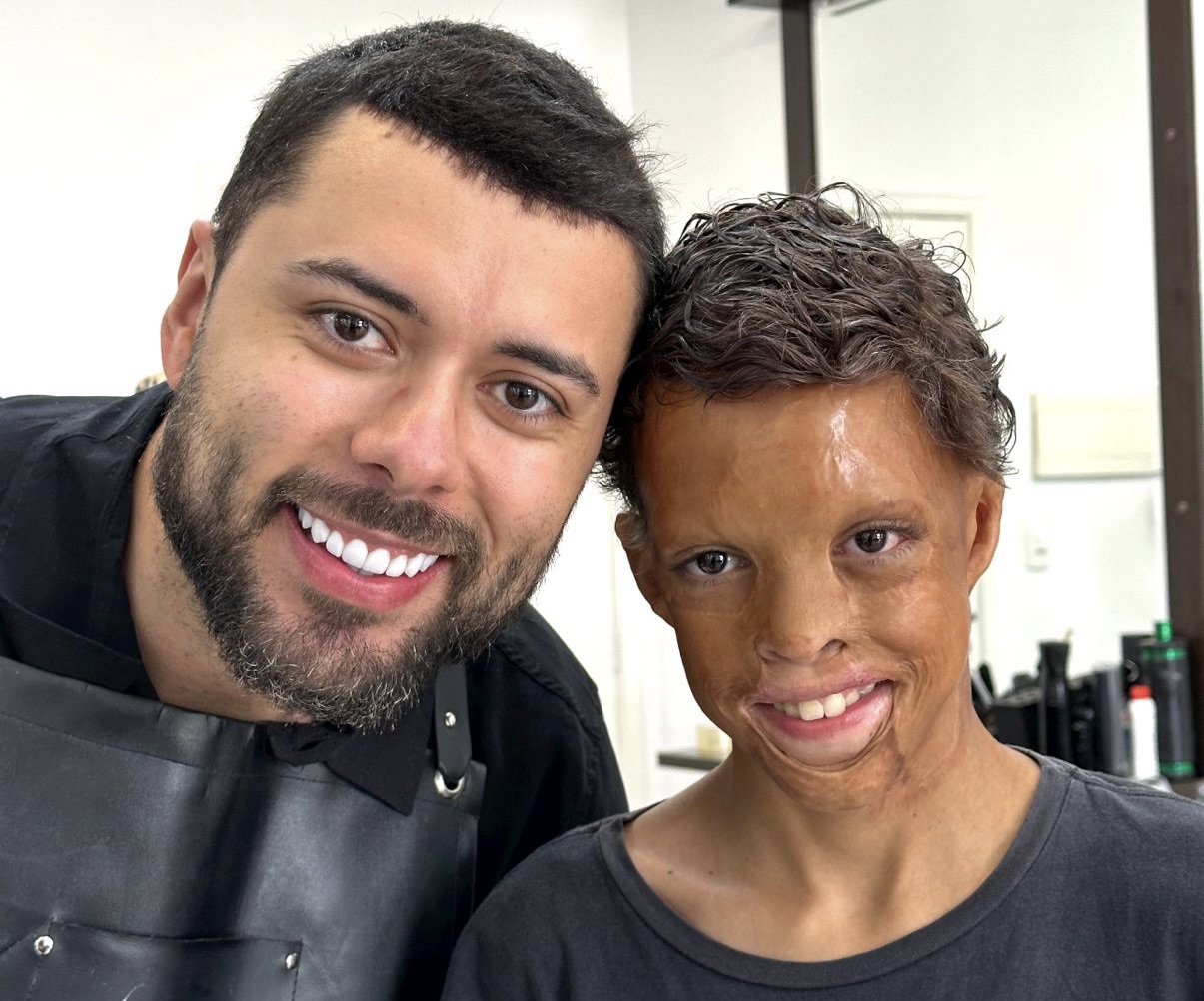 Francisco Emanuel Batista de Oliveira: O Barbeiro que Restaura Sorrisos com Próteses Capilares